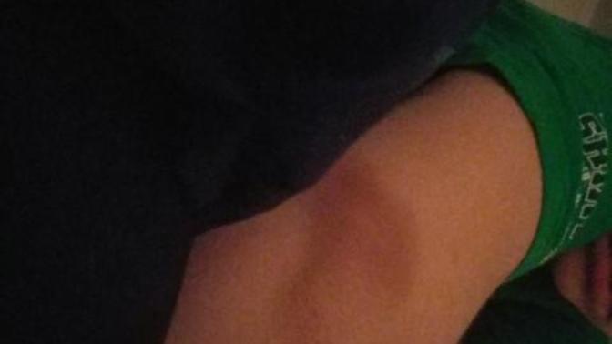Help with my back?