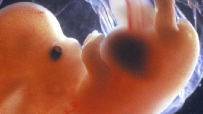 Why do people say Men can't have an opinion on abortion?