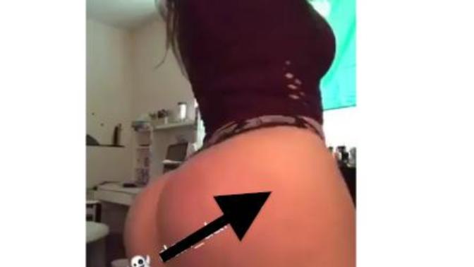 She had surgery on her butt to make it bigger, is it just me or does she look ridiculous?