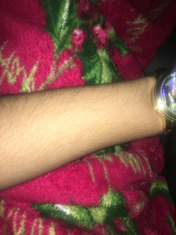 Is it weird that l'm attracted to women with hairy arms?