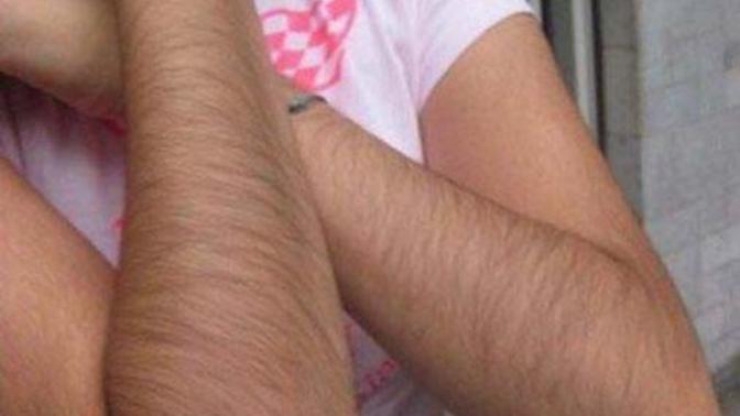 Is it weird that l'm attracted to women with hairy arms?