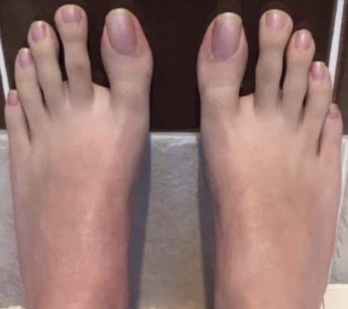 Anyone else have really long toes?