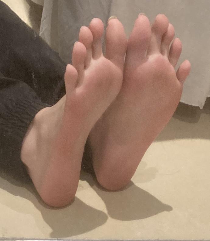 Anyone else have really long toes?