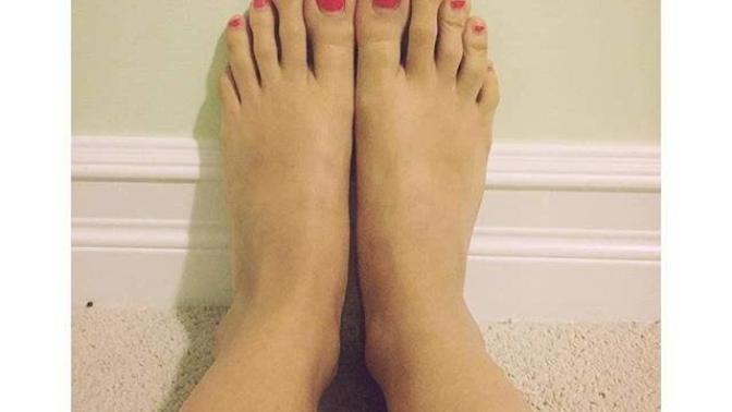 Anyone else have really long toes?