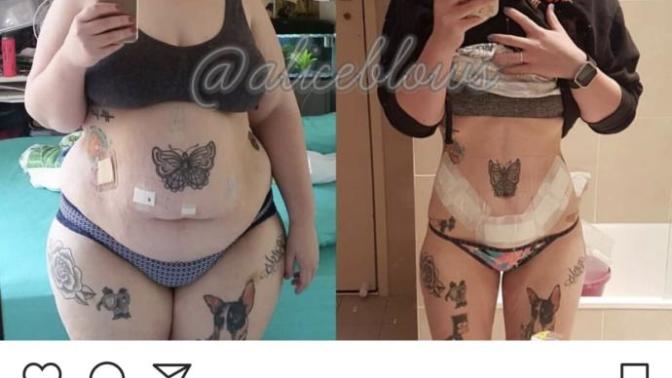 Promoting healthy lifestyle but after the fact?