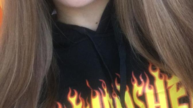 Do you find braces unattractive? Would you kiss a girl with braces or is that a turn off?