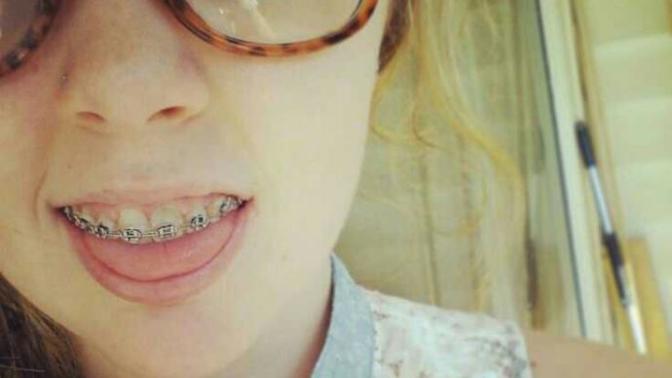Are people that wear glasses and braces considered nerdy?