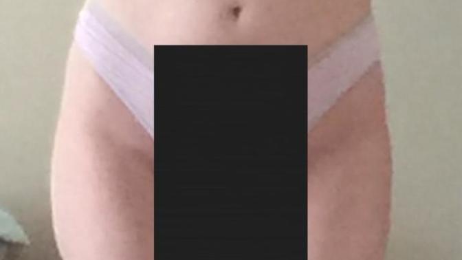 Do I have a hip dip?