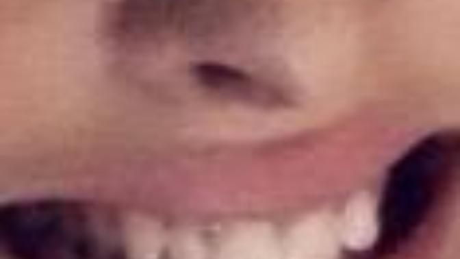 Are my teeth what people would consider "bad teeth" be super honest plss? Am I even allowed to smile in public?