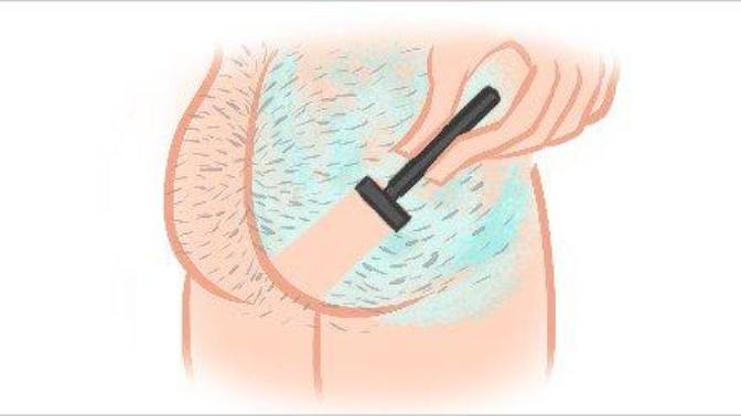 Do guys have to shave their Butt hair?
