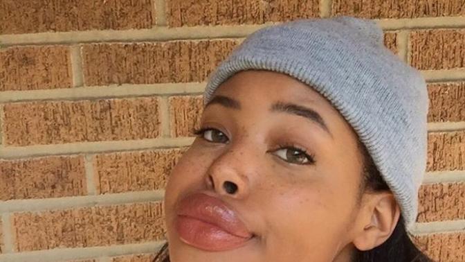 Are this girls lips just way too big?