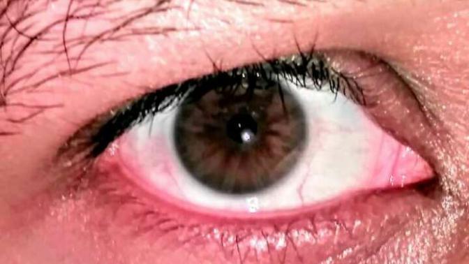 What color are my eyes? One man's question in light of having a poor color vocabulary?