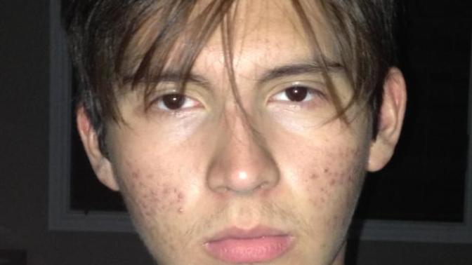 Girls, am I ugly?