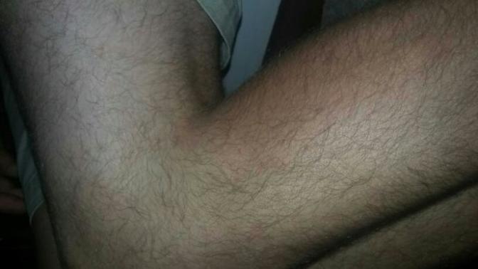 Am I TOO Hairy?