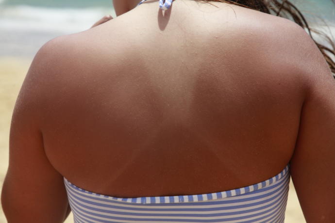 are tan lines atractive?