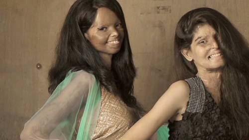 Would you date/marry an acid attack victim?