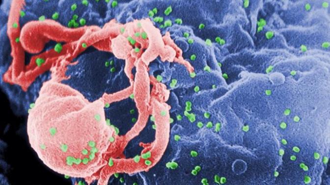 Knowingly exposing others to HIV will no longer be a felony in California?