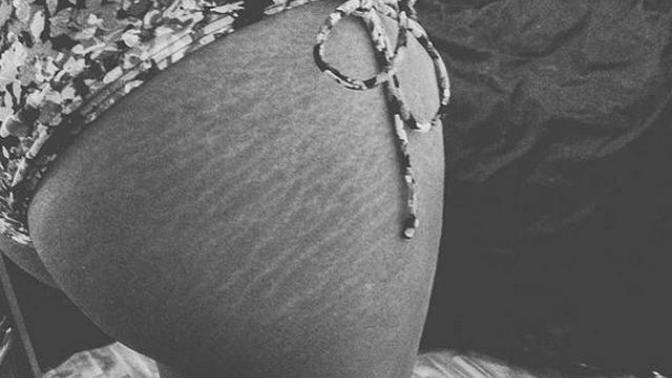 Do you guys really care much for stretch marks on women?