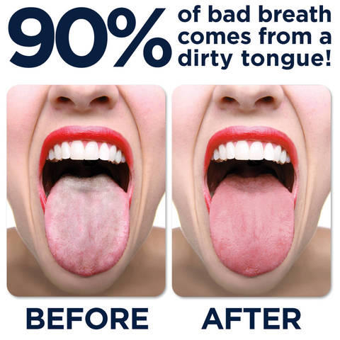 Do you brush your tongue?