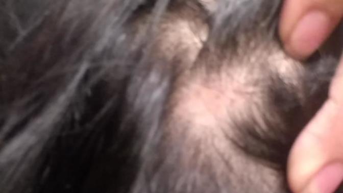 Couple little lumps on scalp? Lost a bit of hair too?