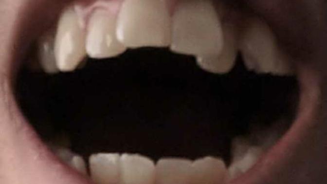 Need some dental help?