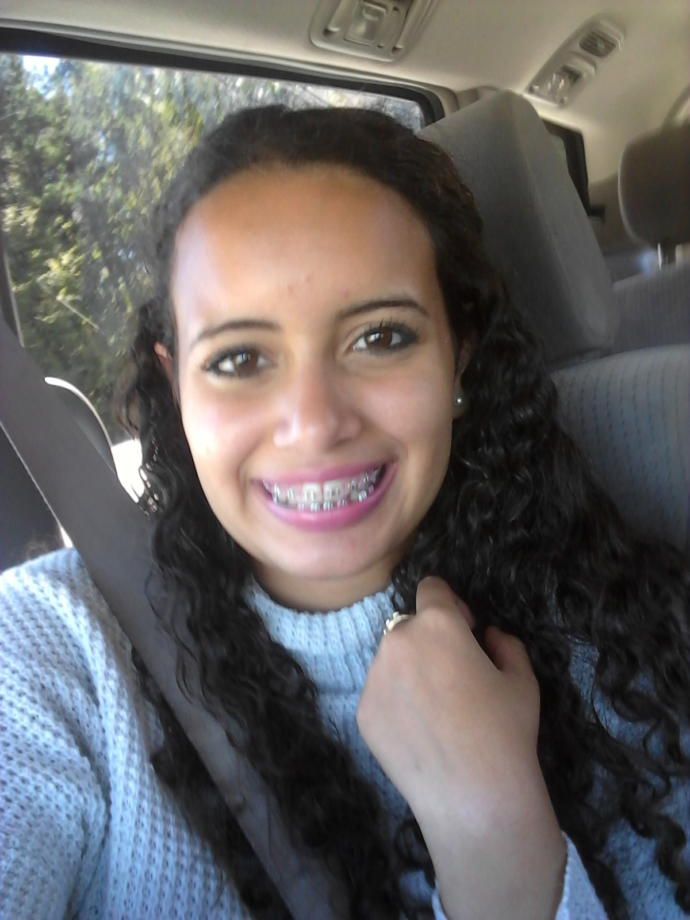How do these new braces look on me?