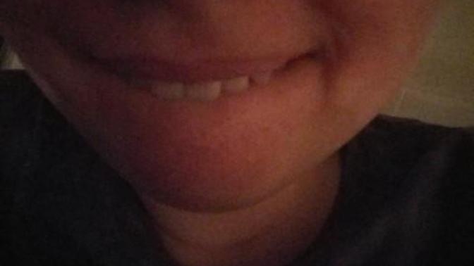 Why I do bite my lip and the surrounding skin?