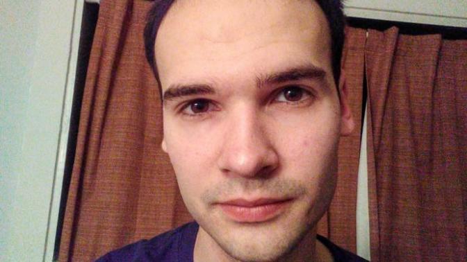 Girls, Am I attractive even though I'm losing my hair?