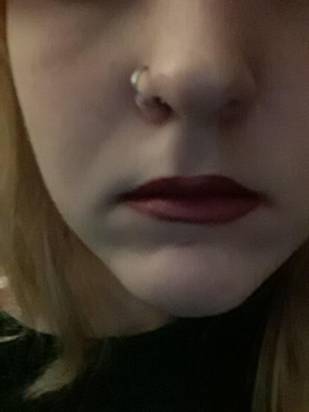 Opinions on lip fillers?