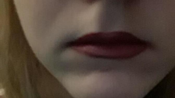 Opinions on lip fillers?