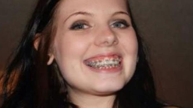 Do I look unpleasant when I smile showing my braces?