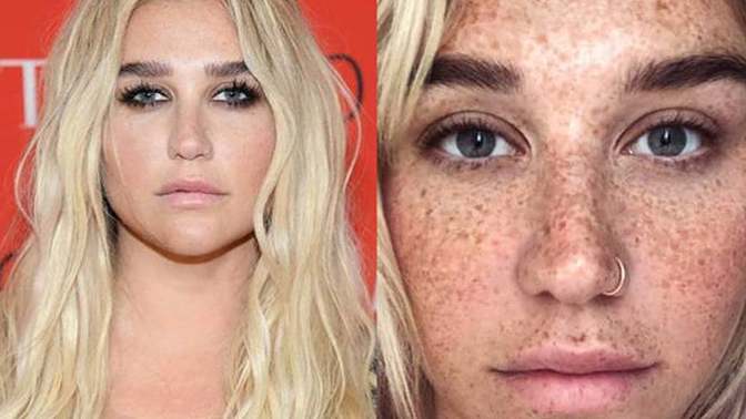 Why do you think women do it: Why do some women think they need to change every aspect of their face to be found attractive or to view themselves as attractive?