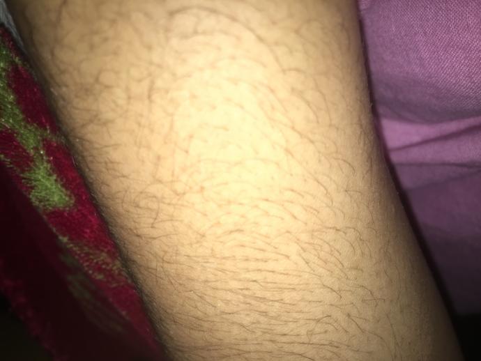 Why do guys expect girls to be completely hairless?