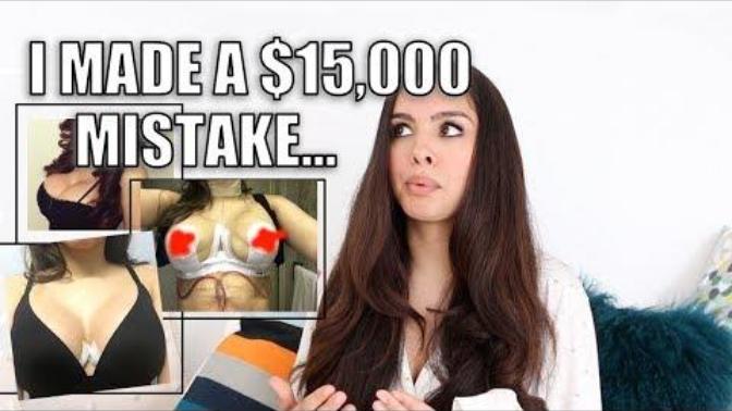 What are your thoughts on plastic surgery AFTER seeing this woman's story?
