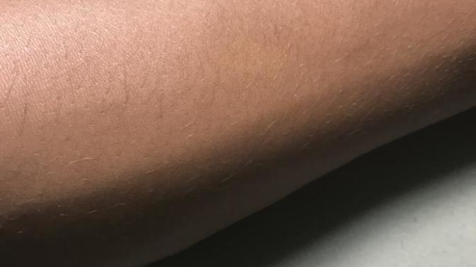 Are there any safe bleaching creams available?