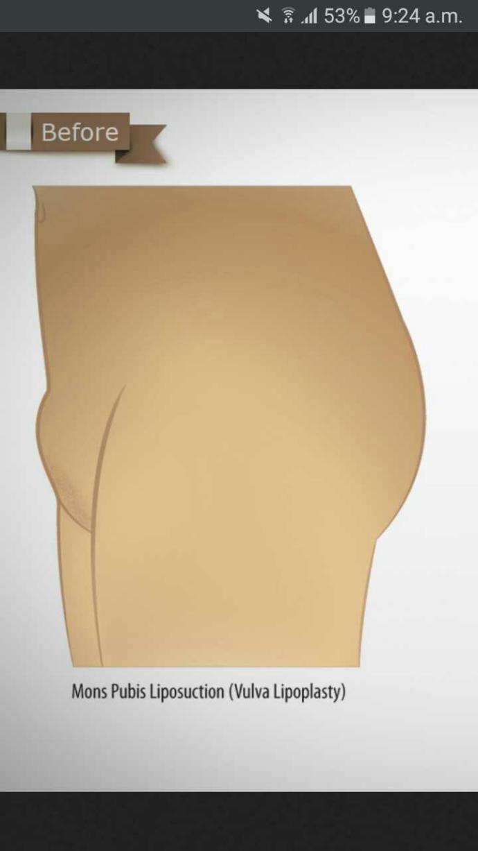 Why do men like fat pussy