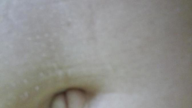 Strange Belly Button?