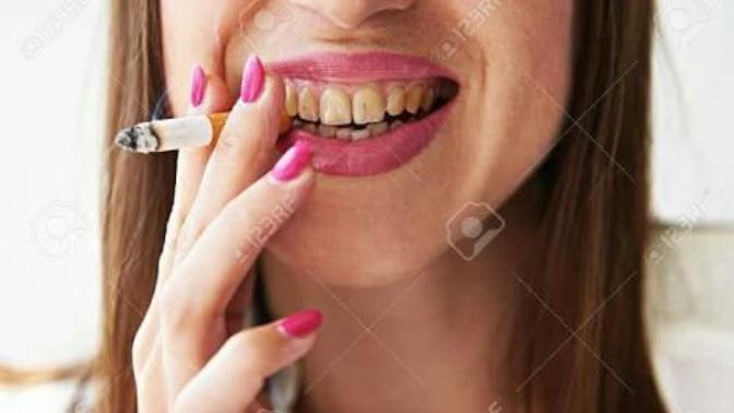 How do movie actors and women in general are able to keep their teeth so white even if they smoke cigarettes?