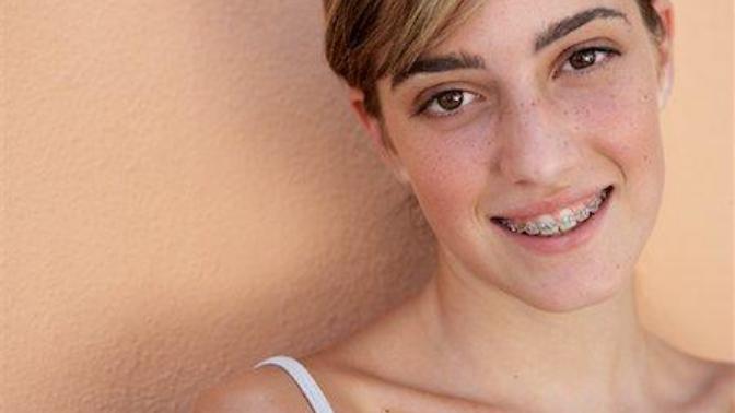 Are braces such a turn off on someone's looks?