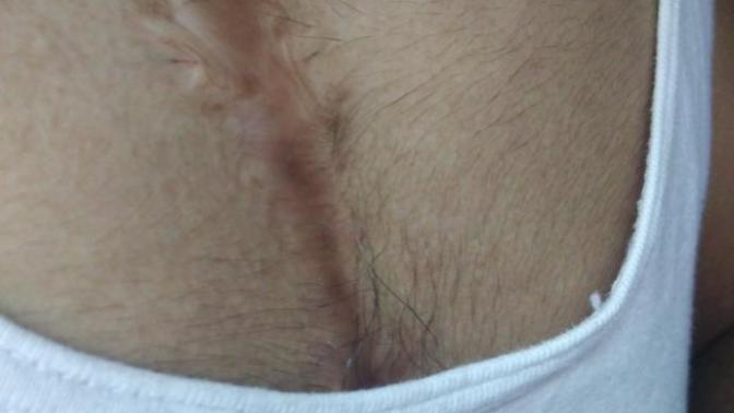 I dont have a girlfriend due to my heart surgery mark what should I do? Can I never get a girl?