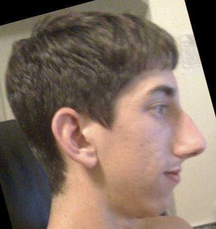 Girls, What facial features make Guys UGLY? and make you reject him?