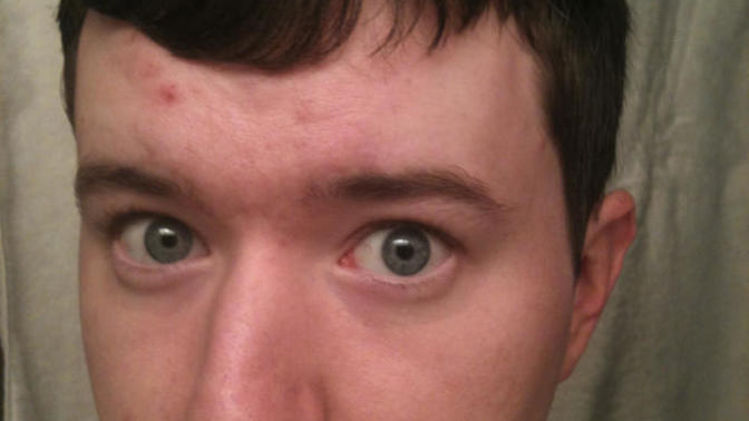 Girls, What facial features make Guys UGLY? and make you reject him?