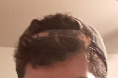 Should backwards baseball caps ever be worn ??