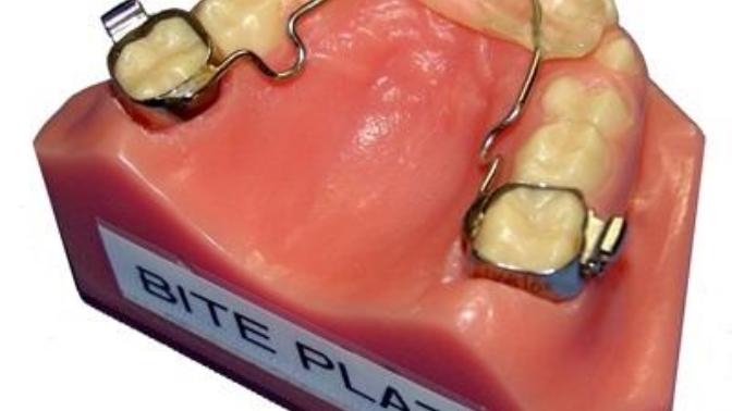 I have to have a thing like this as well as braces, is it worth it?