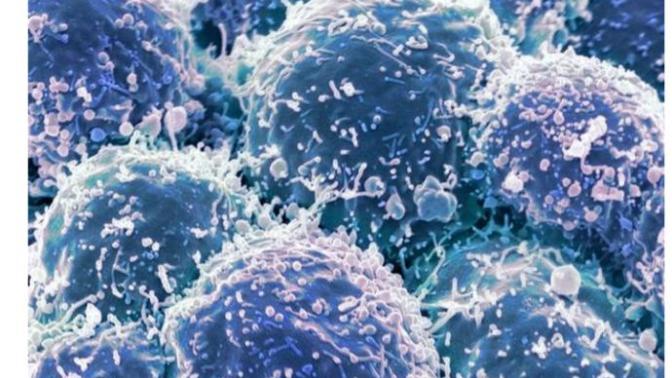 Do you agree with this doctor that cancer is the best way to die?