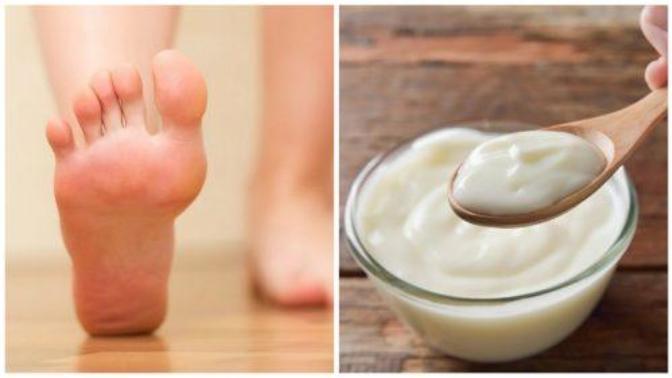 Have you ever soaked your feet in yogurt?
