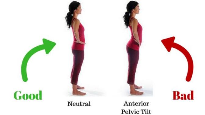 How can I get rid of anterior pelvic tilt (ATP)?