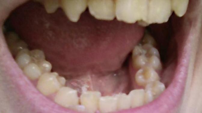 Are my teeth horrible?