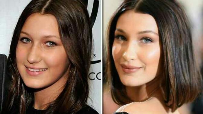 How would you react if your girlfriend told you she had her nose done?