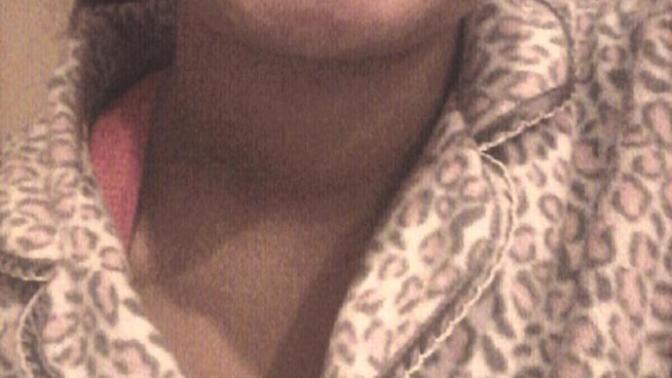 Do I look ready to take my braces off?